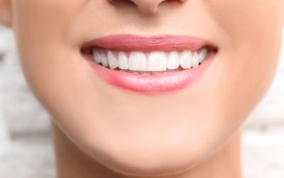 Teeth Bonding 101: Everything You Need to Know About the Procedure