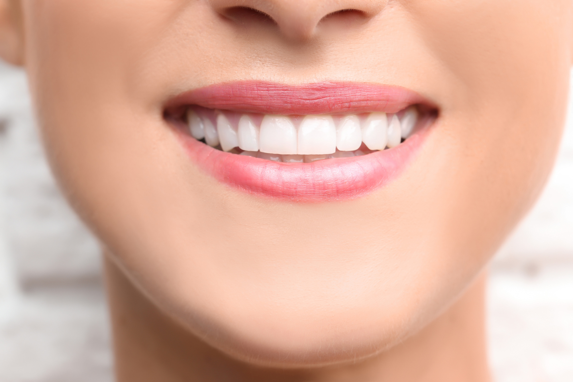 Teeth Bonding 101 Everything You Need to Know About the Procedure