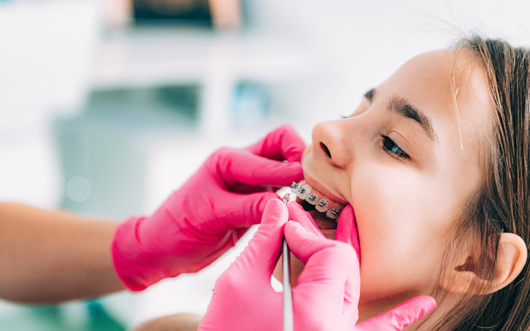 7 Signs Your Child May Need Braces From a Chicago Dentist
